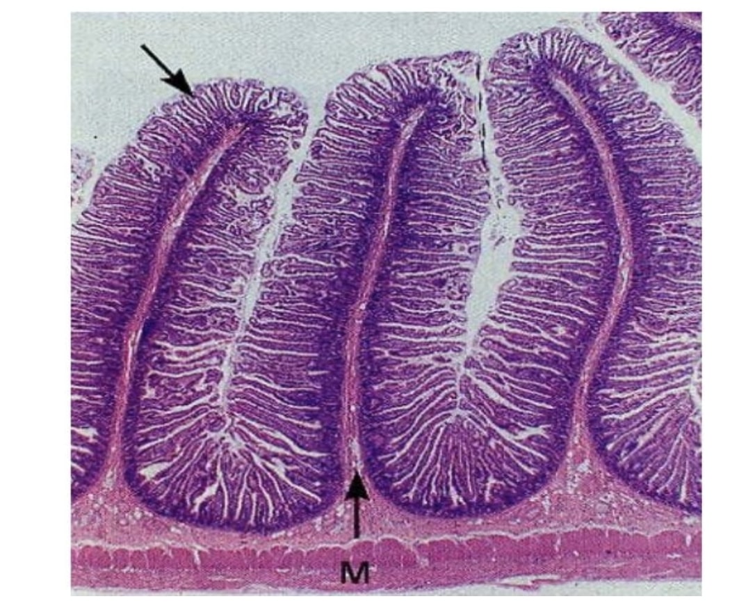 simple columnar epithelium in small intestine 